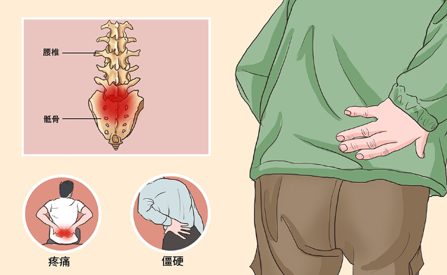 邵陽創(chuàng)傷骨科,邵陽風濕病區(qū),邵陽骨質增生,邵陽關節(jié)病區(qū),邵陽頸椎病區(qū)